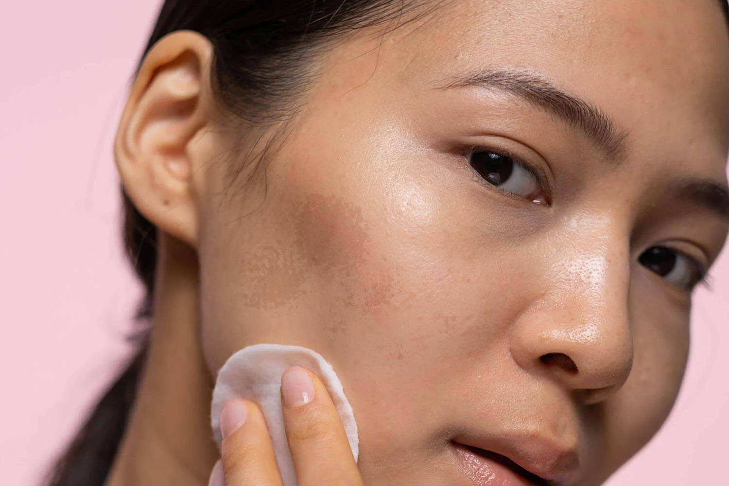 Restylane: Effektive Faltenbehandlung für feine Linien und Krähenfüße mit Hyaluronsäure