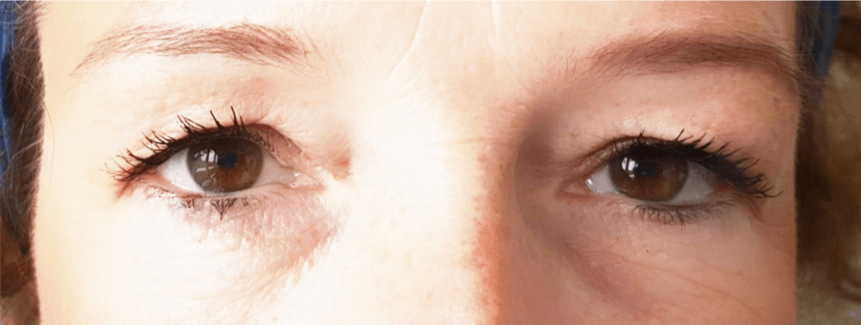 Ihr Partner für Wimpern und Augenbrauen: Vertrauen Sie auf LashLink